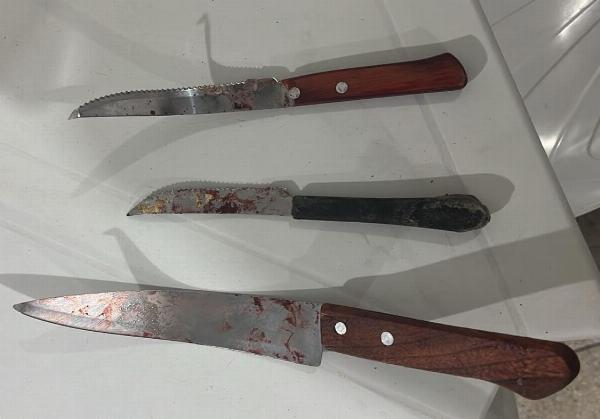 Casal fica ferido após briga motivada por ciúmes em Santaluz