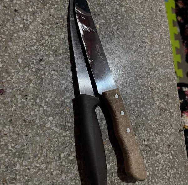 Mulher tem rosto desfigurado após ser agredida por marido e enteado em Conceição do Coité