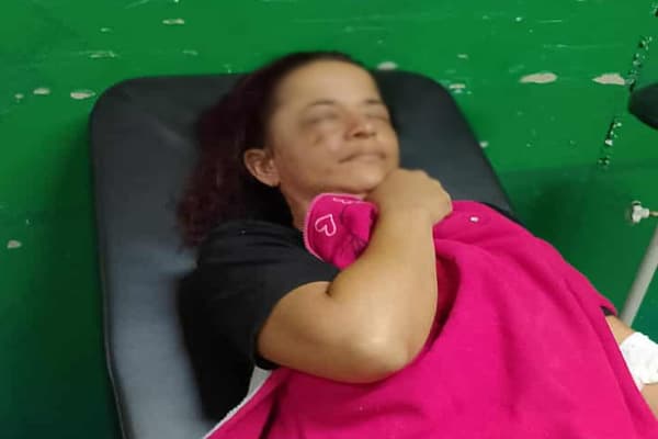 Capim Grosso: Homem tenta sufocar ex-companheira com ácido e é atingido por um martelo pelo filho