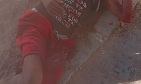 Homem é agredido com pedradas na cabeça em Queimadas