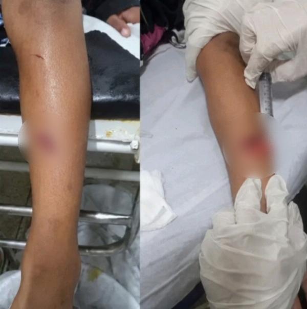 Duas crianças ficam feridas ao defender a mãe de tentativa de feminicídio em Santa Bárbara