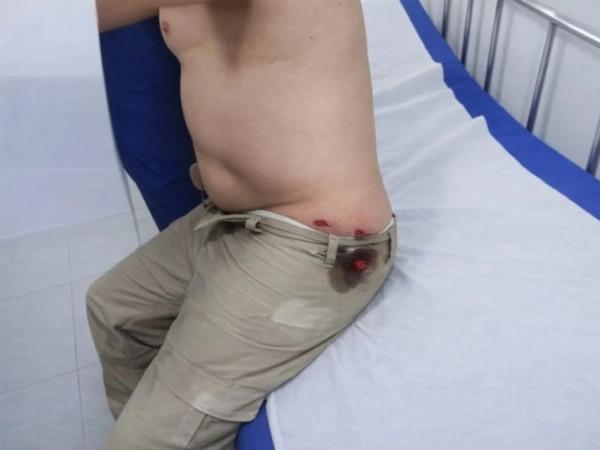 Policial militar é baleado durante operação em Nova Soure